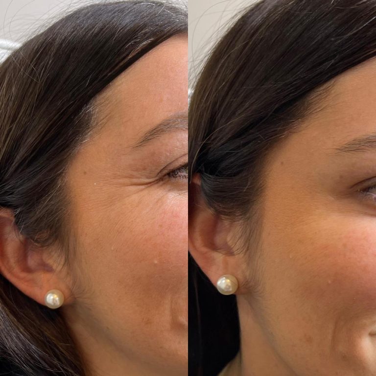 Injectables – Skyn Med Spa
